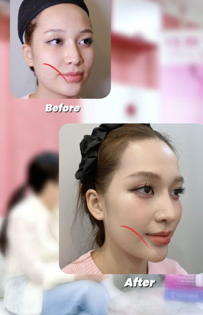 Hoa hậu Kỳ Duyên đã đến đâu để chăm sóc sắc đẹp?