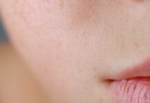 Da thiếu nước và da khô các nàng đã biết cách phân biệt? Da thiếu nước và da khô các nàng đã biết cách phân biệt?