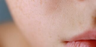 Da thiếu nước và da khô các nàng đã biết cách phân biệt?