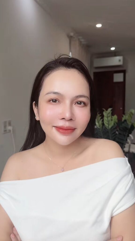 Có nên làm Laser Toning hàng tháng không các nàng?