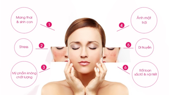 Những sai lầm thường gặp khi điều trị nám da