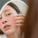 Dấu hiệu nên ngừng sử dụng retinol nàng cần biết